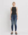 MID RISE ANKLE SKINNY JEANS